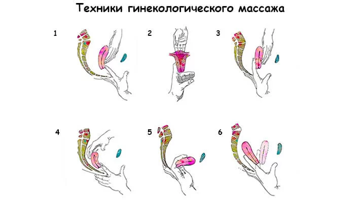 Методика гинекологического массажа матки