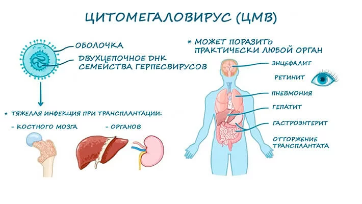 Цитомегаловирус (ЦМВ)