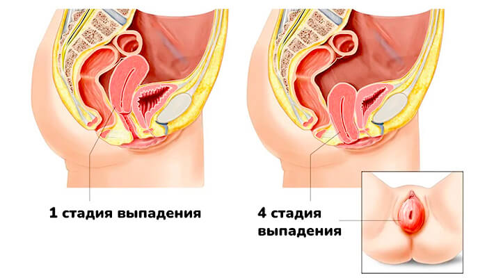 «У женщин меняется походка, появляется интерес к жизни!»