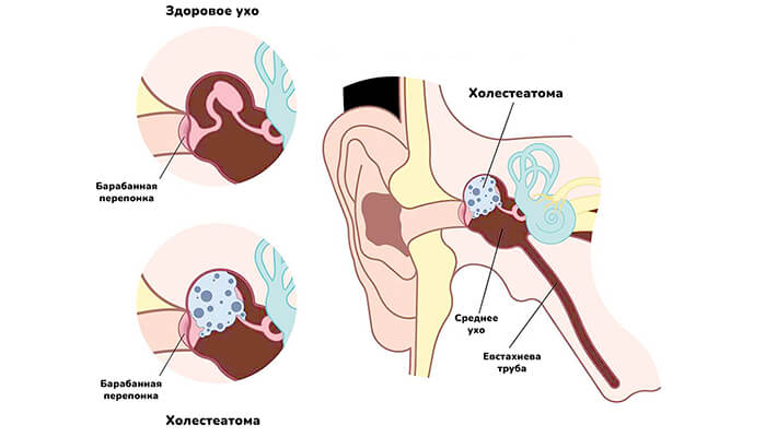 Можно ли заболеть от сквозняка, мороженого и кондиционера