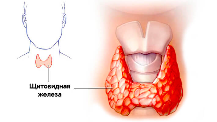 Гиперфункция щитовидной железы