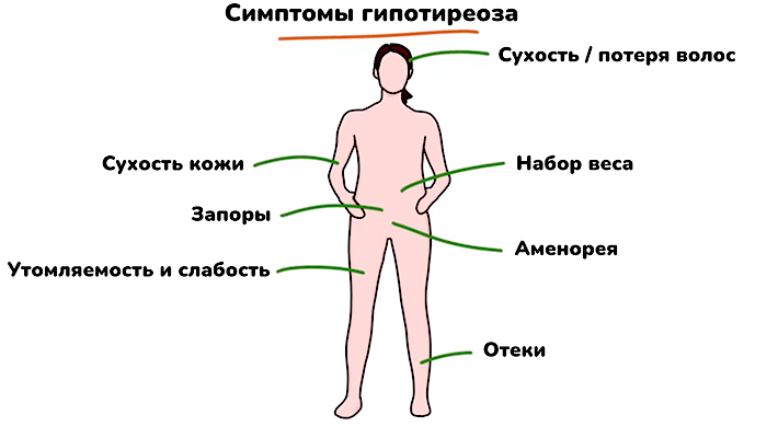 Гипотиреоз – что это, симптомы, диагностика, причины и лечение в «СМ-Клиника»