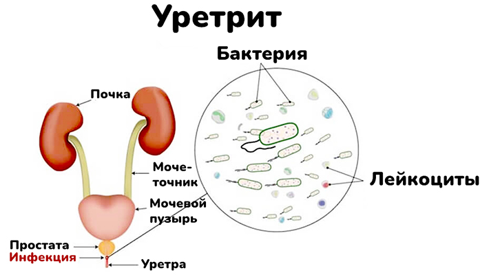 Современный подорожник: как лечить ссадины и раны на коже?